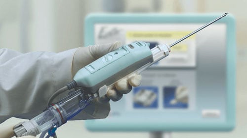 Vacuum-assisted Biopsy