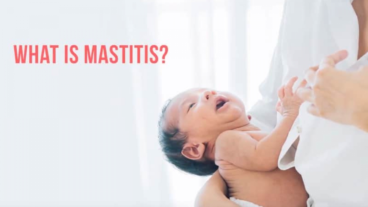 Dr Anthony Tang on Mastitis